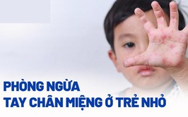 Chủ động phòng, chống bệnh tay chân miệng ở trẻ em 