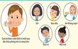 Các biện pháp phòng, chống bệnh quai bị