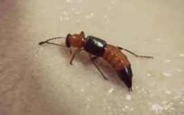 Phối hợp liên tuyến cứu sống người bệnh phản vệ do côn trùng đốt