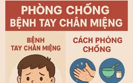 Tăng cường phòng, chống bệnh tay chân miệng và các bệnh truyền nhiễm khác