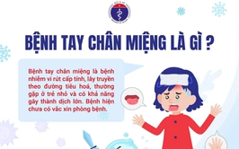 Các biện pháp phòng chống tay chân miệng