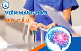 Phòng chống bệnh viêm màng não do não mô cầu
