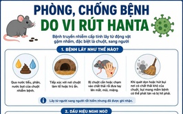  PHÒNG CHỐNG BỆNH DO VI RÚT HANTA
