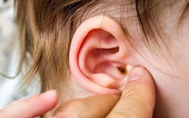 Cần phát hiện sớm, điều trị kịp thời viêm tai giữa để bảo vệ thính lực và sự phát triển của trẻ