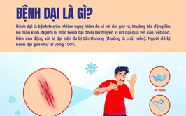 Tăng cường tuyên truyền phòng, chống bệnh dại – Chủ động bảo vệ sức khỏe cộng đồng