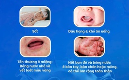 Chủ động nhận biết sớm bệnh tay chân miệng để bảo vệ trẻ nhỏ trước nguy cơ biến chứng nguy hiểm