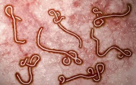 Tăng cường giám sát và phòng, chống bệnh do Ebola vi rút