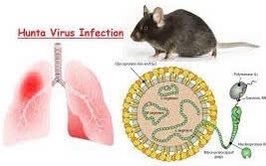 Phòng chống bệnh do Virus Hanta