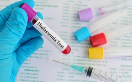 Thalassemia – bệnh di truyền nguy hiểm nhưng hoàn toàn có thể phòng ngừa