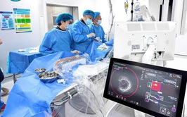 BVĐK Hà Đông làm chủ kỹ thuật siêu âm lòng mạch kết hợp quang phổ cận hồng ngoại hiện đại