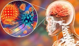 Cảnh báo khẩn: Tuyệt đối không ăn trái cây có dấu hiệu bị động vật cắn dở để phòng vi rút Nipah