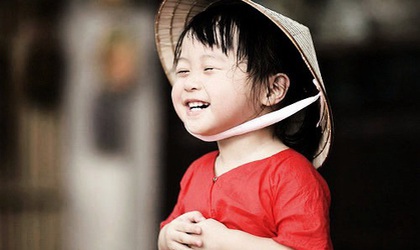 CHƯƠNG TRÌNH PHẪU THUẬT DỊ TẬT VÙNG HÀM MẶT TẠI BỆNH VIỆN TRUNG ƯƠNG QUÂN ĐỘI 108