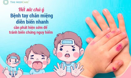 Vì sức khỏe của trẻ, hãy chung tay phòng chống bệnh tay chân miệng