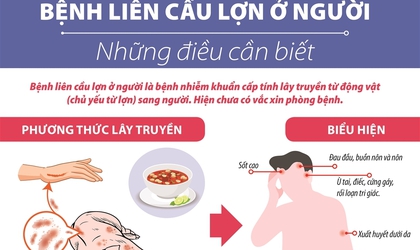 Các thông điệp phòng chống bệnh liên cầu lợn ở người