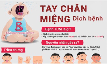 Dấu hiệu nhận biết bệnh Tay chân miệng