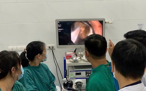 Bệnh viện Đa khoa huyện Thường Tín: Gắp thành công dị vật bàn chải đánh răng trong dạ dày bằng nội soi gây mê