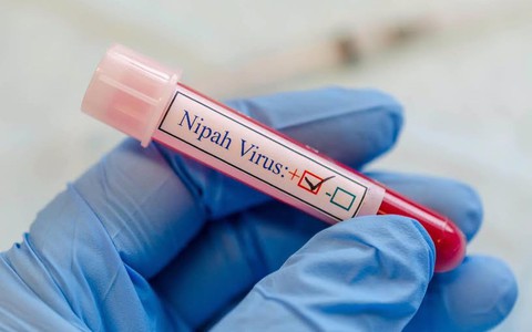 Dịch bệnh do vi rút Nipah và khuyến cáo của ngành y tế