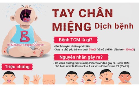 Dấu hiệu nhận biết bệnh Tay chân miệng
