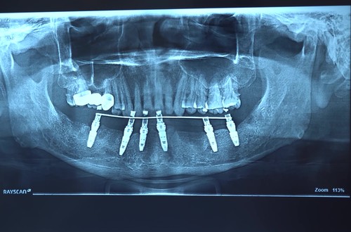 Thực trạng sức khỏe răng miệng cần được quan tâm đúng mức