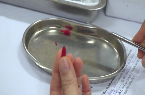 Triển khai uống VitaminA trên toàn thành phố