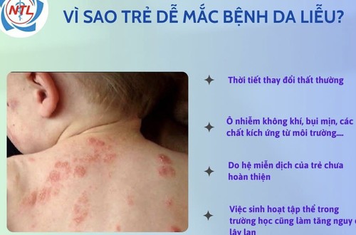Cảnh giác với bệnh da liễu ở trẻ nhỏ
