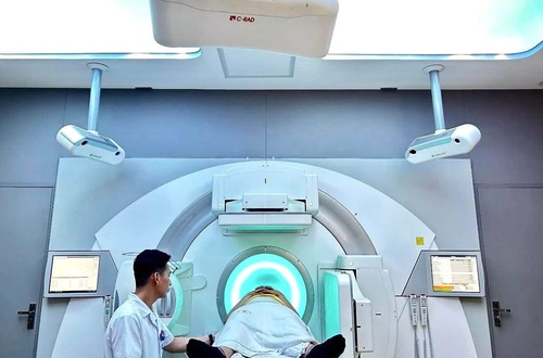 Xạ trị không xăm hình định vị: Bước tiến mới tại Bệnh viện Ung Bướu Hà Nội