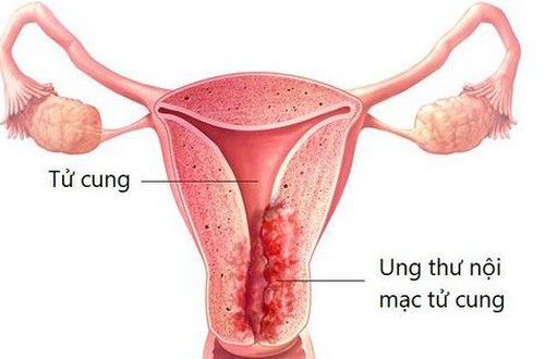 Cảnh giác với những bệnh lý ở phụ nữ sau mãn kinh