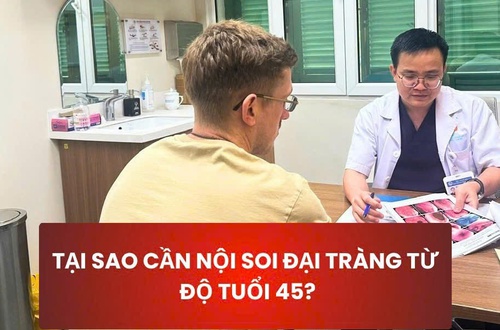 Tại sao cần nội soi đại tràng từ độ tuổi trung niên?
