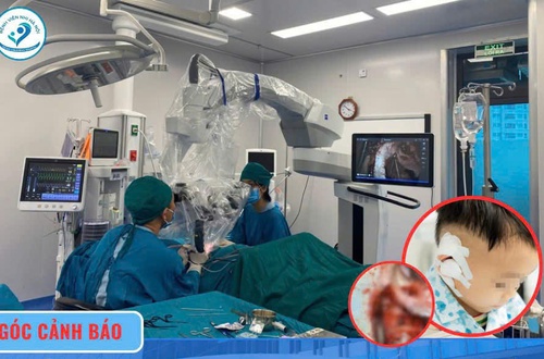 Bệnh viện Nhi Hà Nội: Cảnh báo U lympho hodgkin ở trẻ