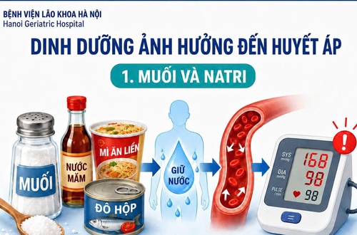 Dinh dưỡng ảnh hưởng thế nào đến huyết áp - Khuyến cáo từ Bệnh viện Lão khoa Hà Nội