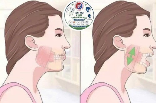 Đừng chủ quan với cơn đau hàm mặt kéo dài