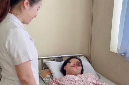 Bệnh viện đa khoa Gia Lâm: Cấp cứu thành công ca chửa ngoài tử cung vỡ - sốc mất máu nặng