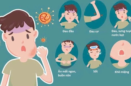 Nhận biết sớm bệnh quai bị để phòng ngừa biến chứng và hạn chế lây lan trong cộng đồng