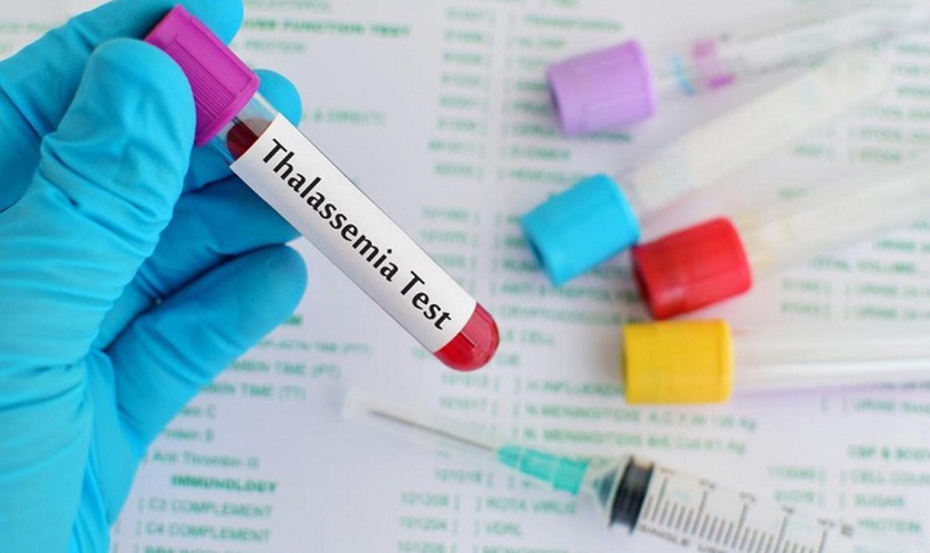Thalassemia – bệnh di truyền nguy hiểm nhưng hoàn toàn có thể phòng ngừa