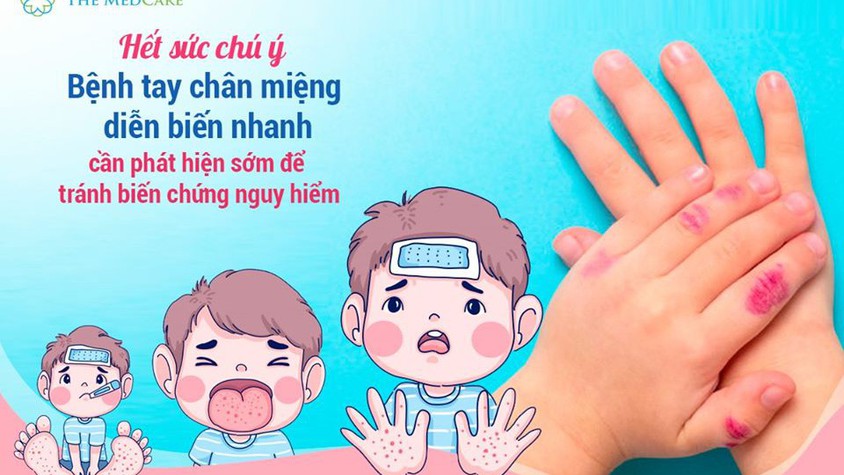 Vì sức khỏe của trẻ, hãy chung tay phòng chống bệnh tay chân miệng