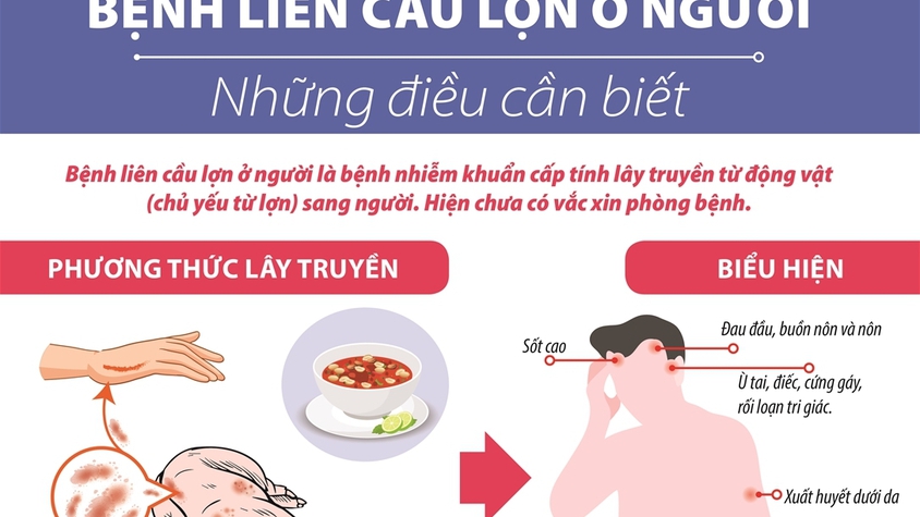 Các thông điệp phòng chống bệnh liên cầu lợn ở người