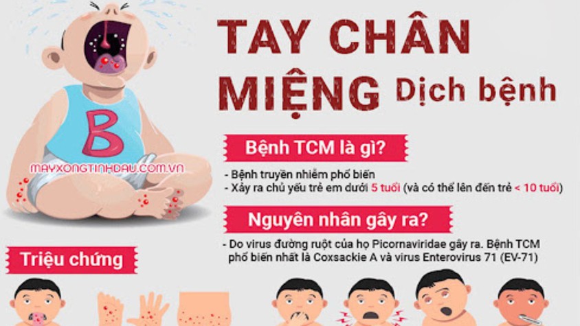 Dấu hiệu nhận biết bệnh Tay chân miệng