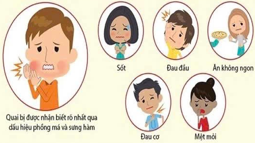 Các biện pháp phòng, chống bệnh quai bị