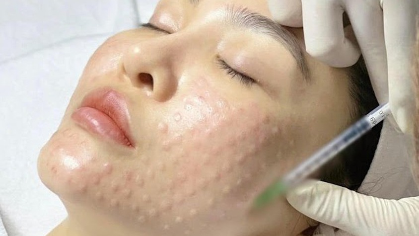 Lựa chọn cơ sở thẩm mỹ hợp pháp, an toàn – Bảo vệ sức khỏe và sắc đẹp