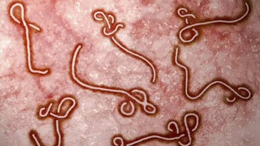 Tăng cường giám sát và phòng, chống bệnh do Ebola vi rút
