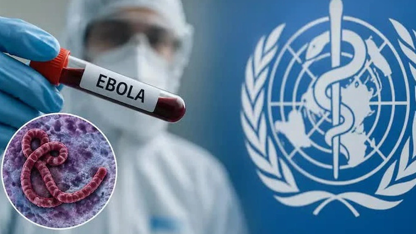 Phòng chống bệnh do Ebola Virus